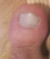 A big toe